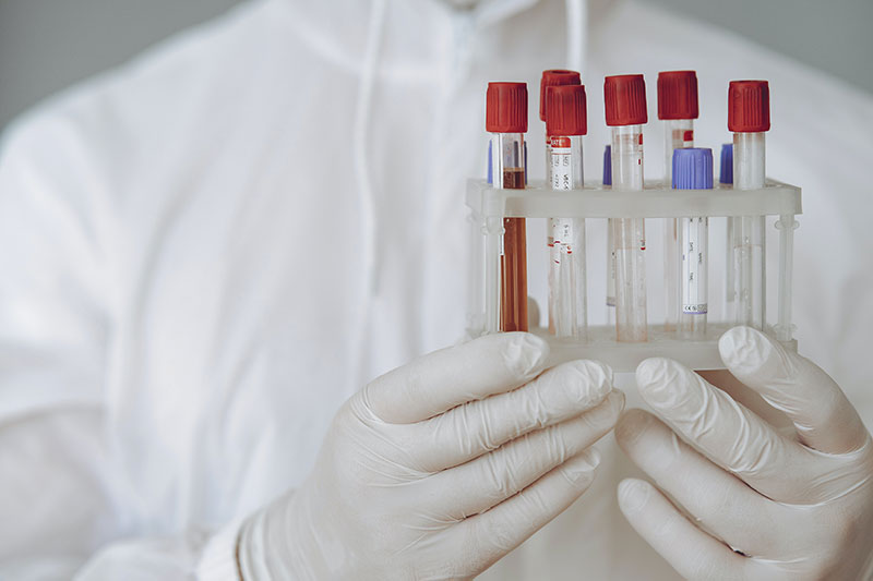 Laboratorio Analisi