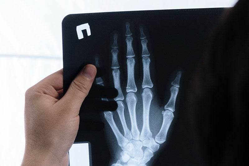 Diagnostica per immagini